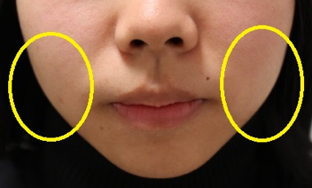 〇：頬の部分