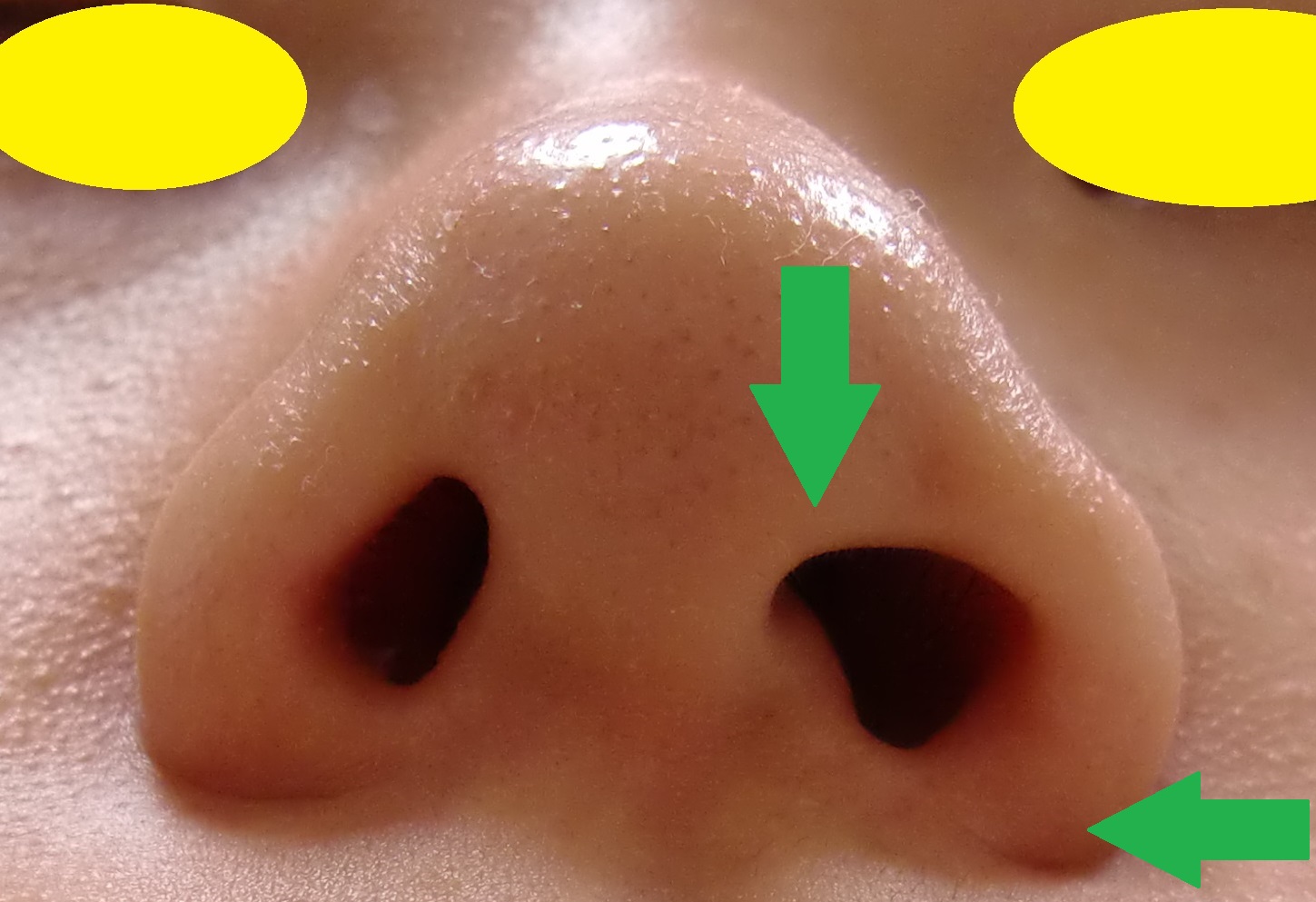 图3—4 鼻后孔及其周围结构-眼耳鼻喉-医学