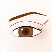 eye_double_incision[1]